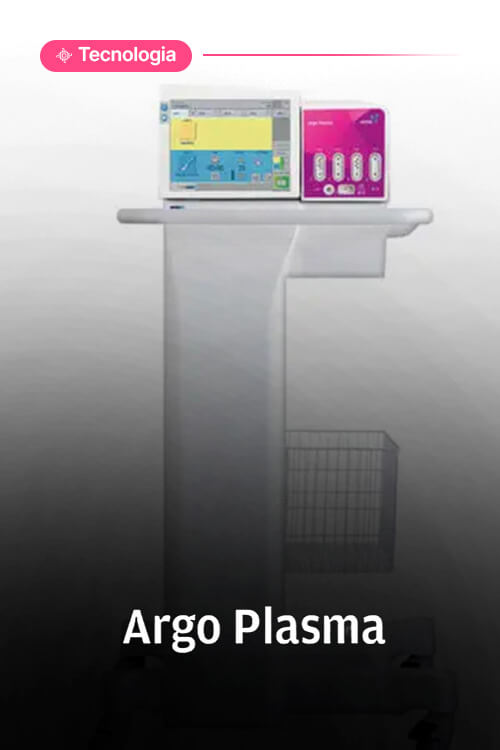 argoplasma
